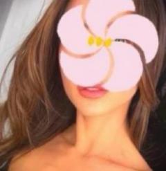 Erotic Escort Massage – Today's photo of Milla(32) Photo15801